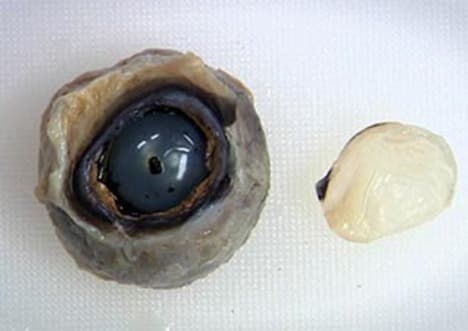 Dissection: Eye