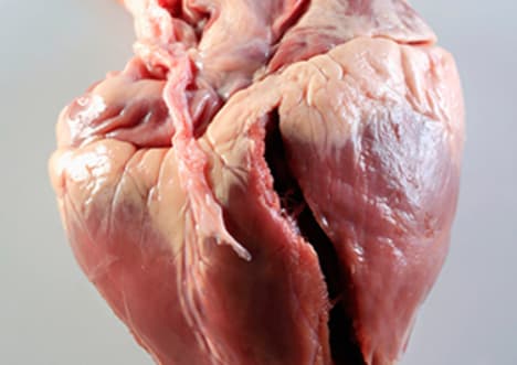 Heart