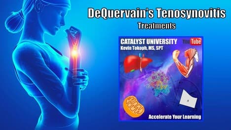 DeQuervain's Tenosynovitis | Treatments