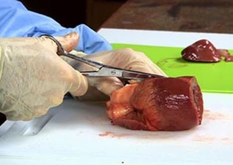 Dissection: Heart