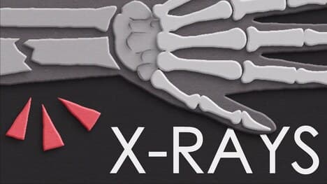 Why and how do we use X-rays in medicine