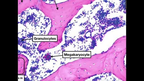 Major Parts of Long Bones | Compact & Spongy Bone Histology