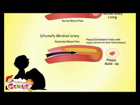 What is High & Low Blood Pressure - Video for Kids