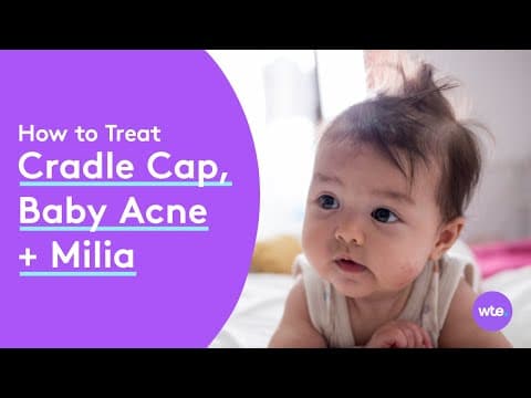 How to treat your baby's acne, cradle cap and other rashes (plus, why it happens!)