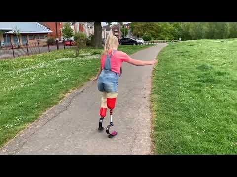 Double amputee does 40 cartwheels for charity