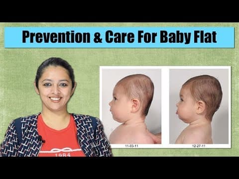 How to maintain baby head shape-flat head prevention and cure