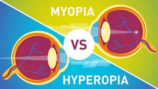Difference between Myopia |Near Sightedness And Hyperopia Farsightedness