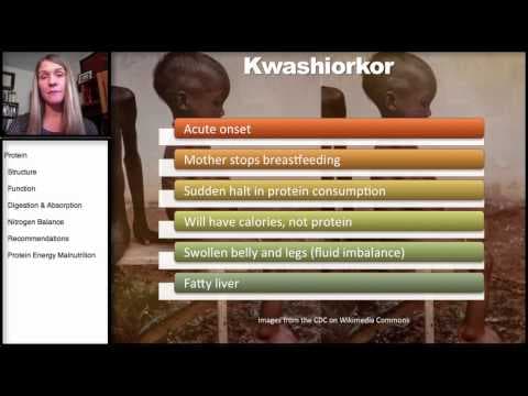 Protein: Protein Energy Malnutrition