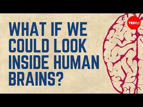 What if we could look inside human brains?